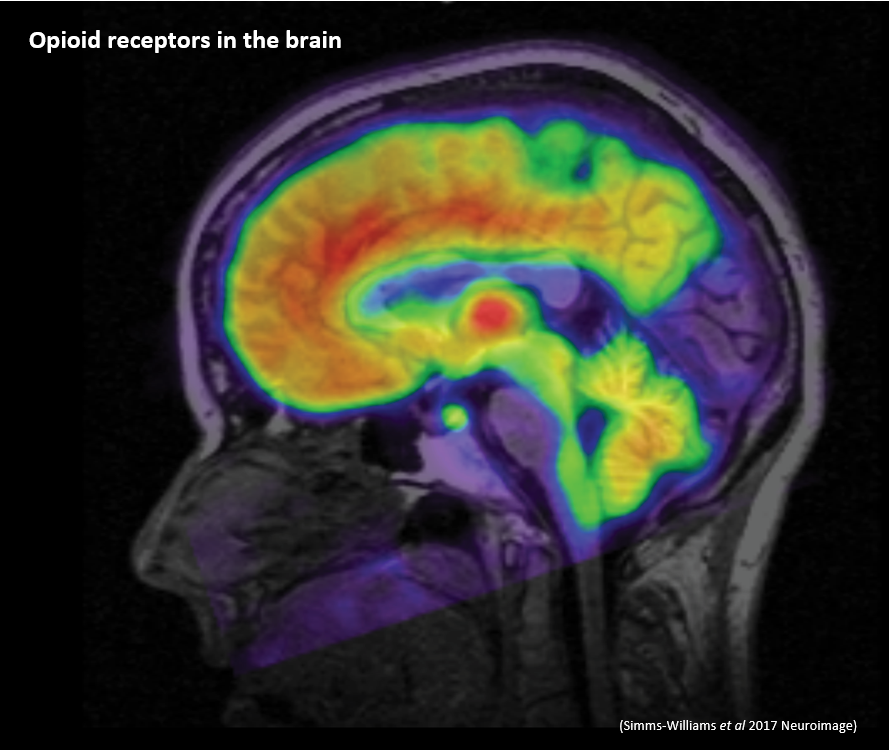 Image - opioid receptors in the brain